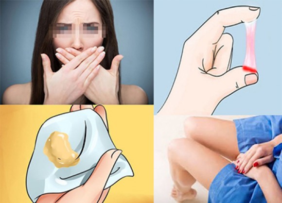 Khí hư bất thường